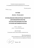 Ротин, Даниил Леонидович. Использование компьютерных технологий для повышения качества гистологической диагностики опухолей щитовидной железы: дис. кандидат медицинских наук: 14.00.14 - Онкология. Москва. 2005. 130 с.