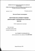 Богосьян, Родион Александрович. Хирургическое лечение рубцовых деформаций глазничной области после ожогов: дис. кандидат медицинских наук: 14.00.22 - Травматология и ортопедия. Нижний Новгород. 2003. 152 с.