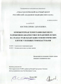 Костина, Ирина Эдуардовна. Компьютерная томография высокого разрешения в диагностике поражений легких не этапах трансплантации гемопоэтических клеток у больных гемобластозами: дис. кандидат медицинских наук: 14.00.29 - Гематология и переливание крови. Москва. 2009. 151 с.