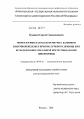 Кузнецов, Сергей Станиславович. Морфологическая характеристика карцином молочной железы и прогноз лучевого лечения при применении локальной интерстициальной гипертермии: дис. доктор медицинских наук: 14.00.15 - Патологическая анатомия. Москва. 2004. 196 с.