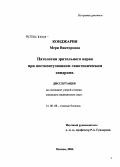 Конджария, Мери Викторовна. Патология зрительного нерва при постконтузионном гипотоническом синдроме: дис. кандидат медицинских наук: 14.00.08 - Глазные болезни. Москва. 2004. 144 с.