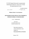 Боброва, Лариса Александровна. Поражение почек при наследственных и приобретенных тромбофилиях: дис. кандидат медицинских наук: 14.01.29 - Нефрология. Москва. 2010. 220 с.