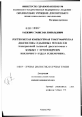 Радзевич, Станислав Леопольдович. Рентгеновская компьютерная томографическая диагностика отдаленных результатов пункционной лазерной дискэктомии у больных остеохондрозом поясничного отдела позвоночника: дис. кандидат медицинских наук: 14.00.19 - Лучевая диагностика, лучевая терапия. Казань. 2002. 120 с.